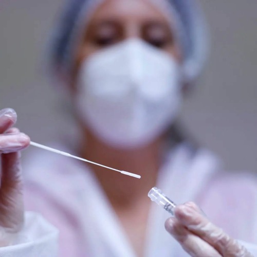 High Cost of PCR Tests Affects SA’s Covid Management